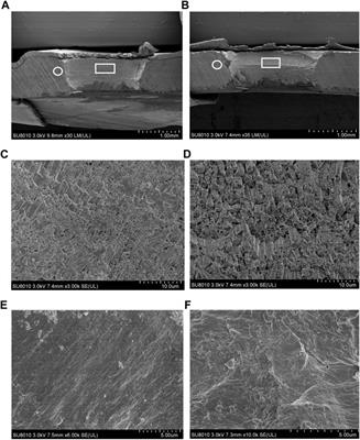 Transcriptomic response of Mytilus coruscus mantle to acute sea water acidification and shell damage